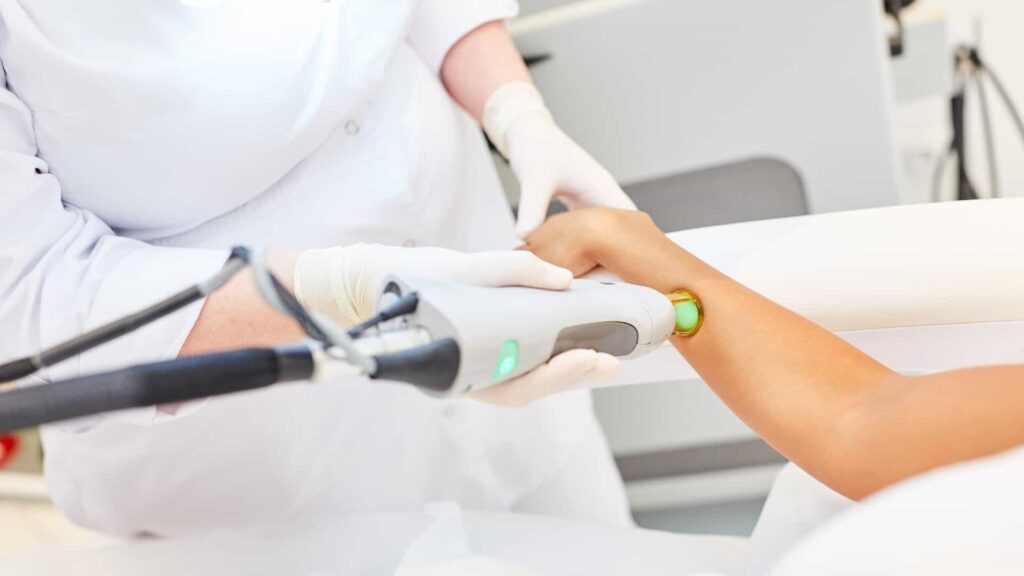 Benefits of Cold Laser Therapy