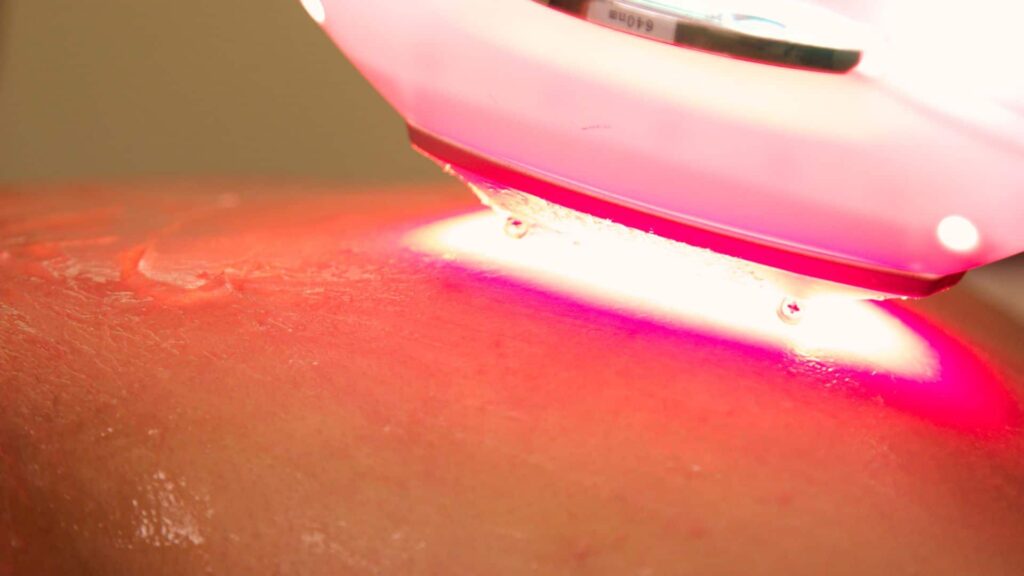 High-Power Laser Therapy