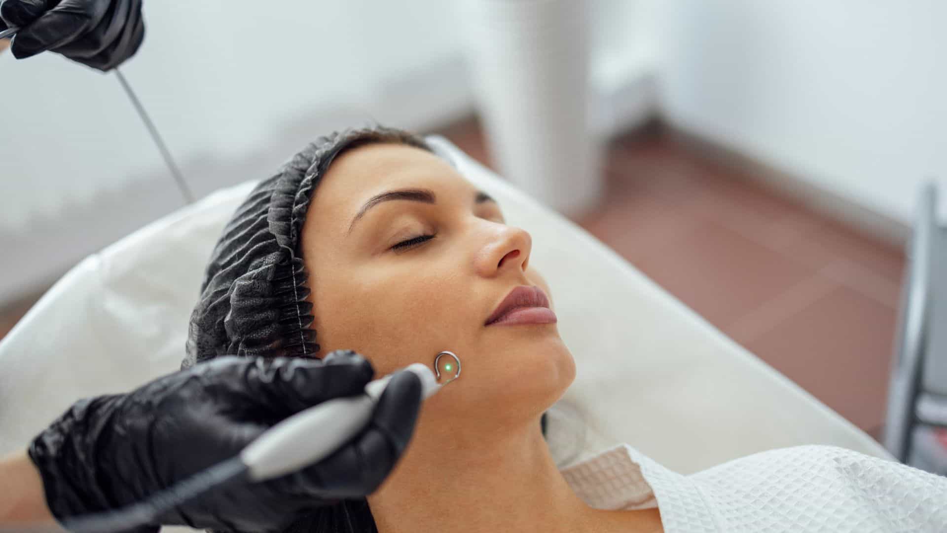 Laser Acne and Scar Treatment