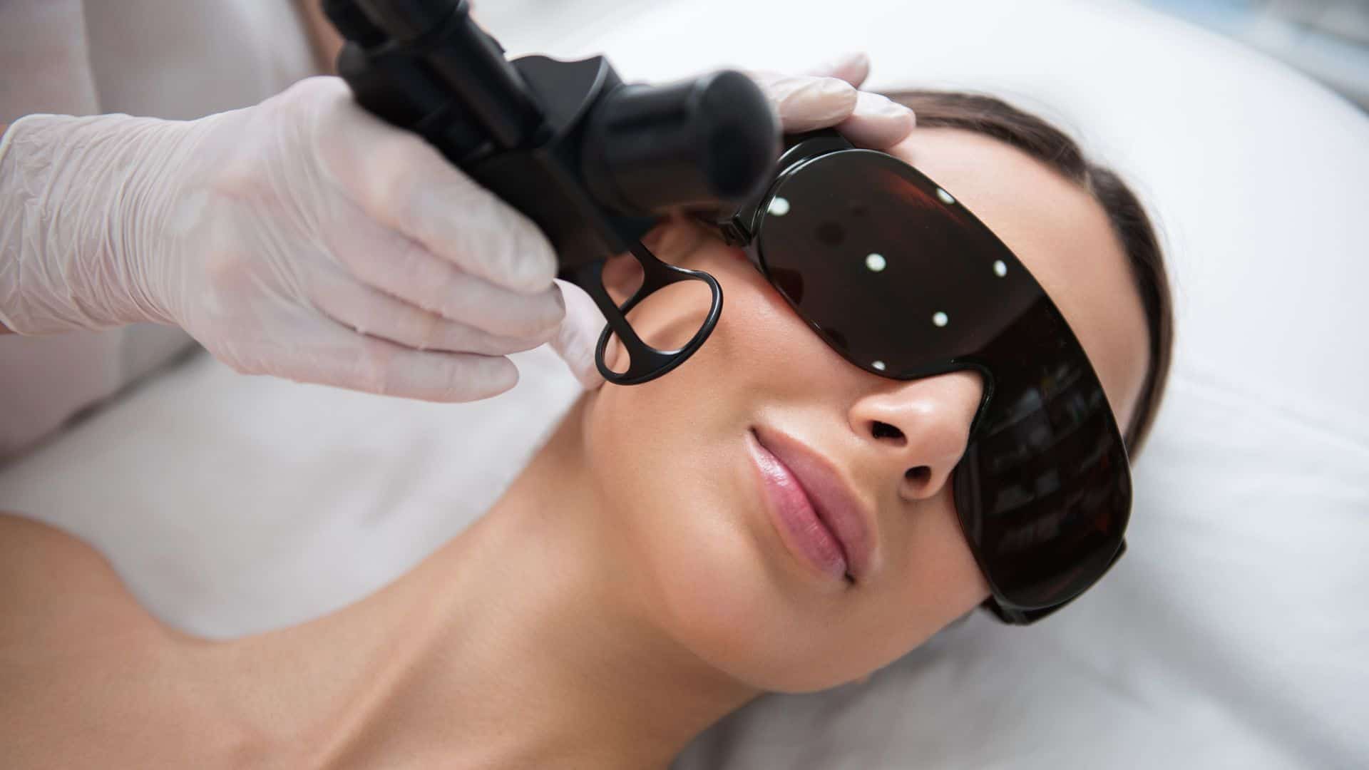 Laser Skin Rejuvenation